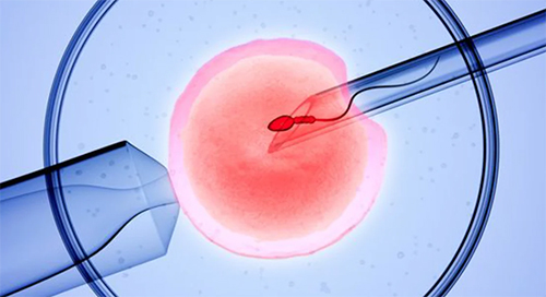Understanding IVF